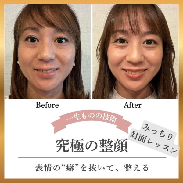 【Iyasaka特別価格❗️】3ヶ月継続対面／表情癖抜きトレーニング