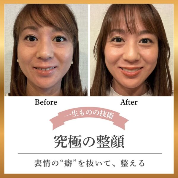 あなたの表情”癖”見抜きます！【1月23日9:30〜】