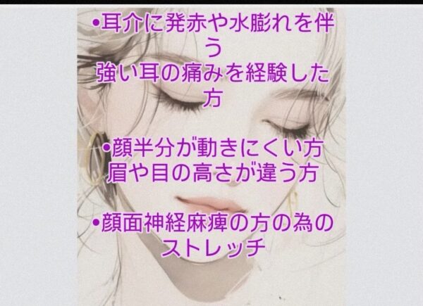 顔面神経麻痺を患っている方へ