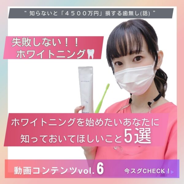 まいまいのお口から成功塾 【第６回】失敗しないホワイトニング。ホワイトニングを始めたいあなたに知っておいてほしいこと５選