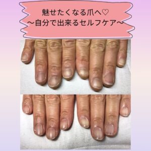 魅せたくなる爪へ（自分で出来るセルフネイルケア）