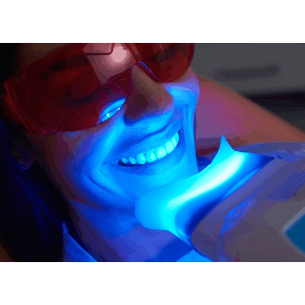 セルフホワイトニング(30分)