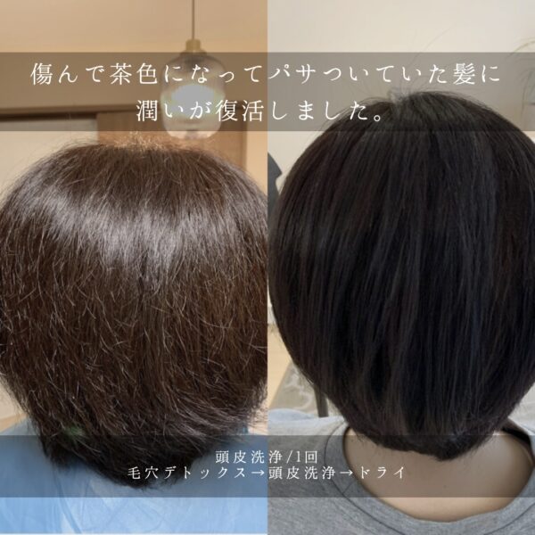 【勉強ジンジャー】育毛美容師が教えるスパニストのための毛髪理論11/1(土)21:00