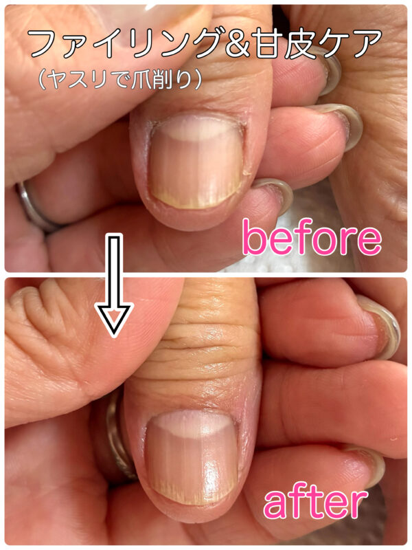 【自爪育成】施術100人チャレンジ（ネイルケア）