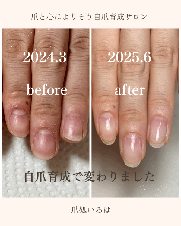 【自爪育成】施術100人チャレンジ（ジェル育成）