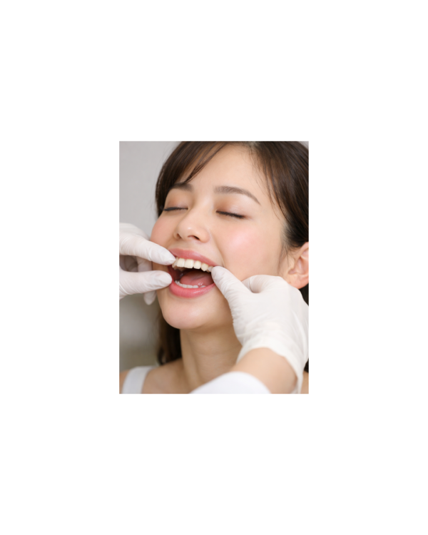 口元集中ケア(45分)