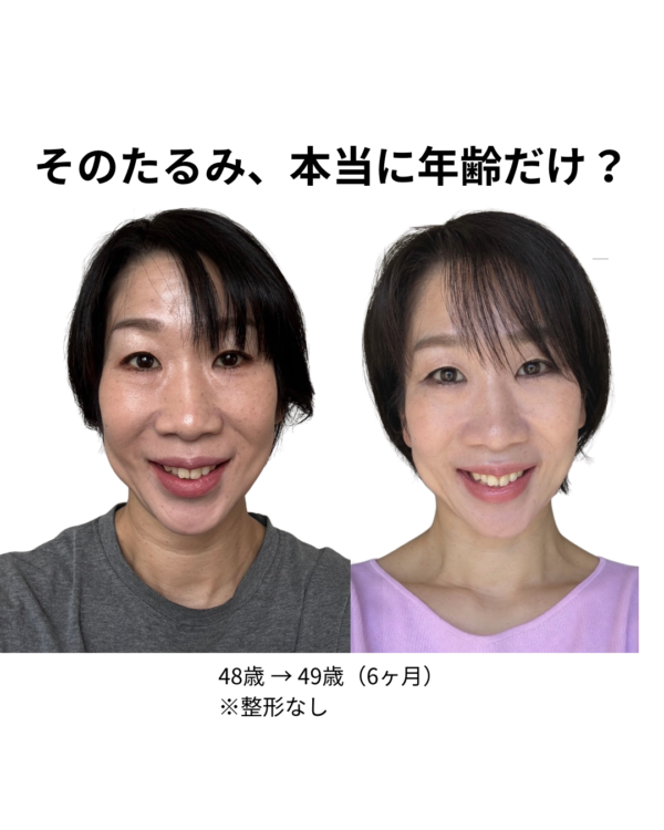 アイリフト3ヶ月集中講座